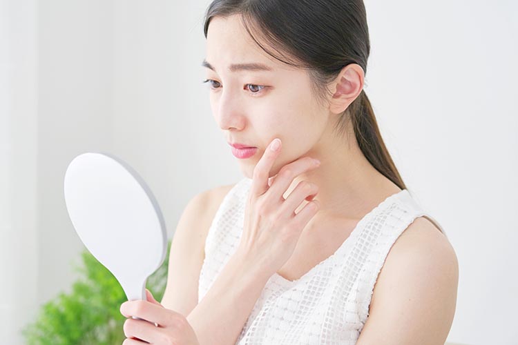 ニキビのイメージ画像