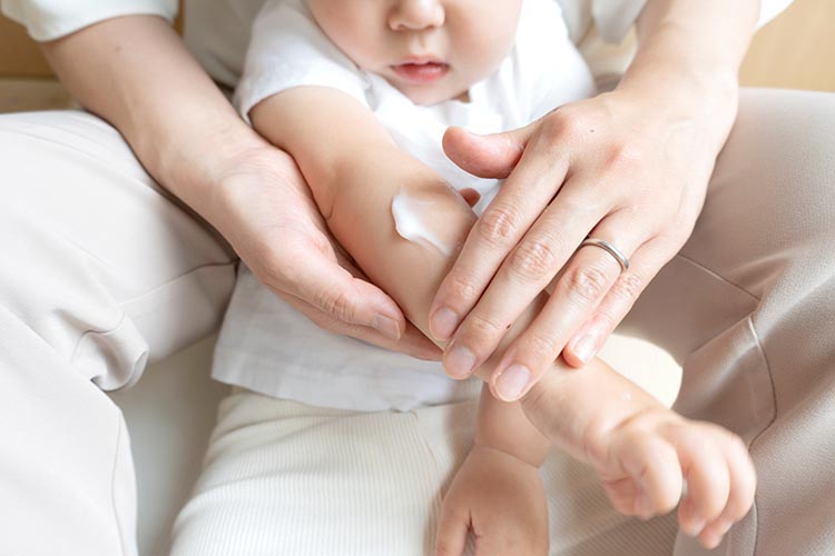 小児皮膚科のイメージ画像